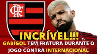 INCRÍVEL!!! GABIGOL SOFRE FRATURA NO JOGO CONTRA INTERNACIONAL - É TRETA!!!