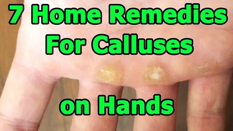 7 Home Remedies For Calluses on Your Hands