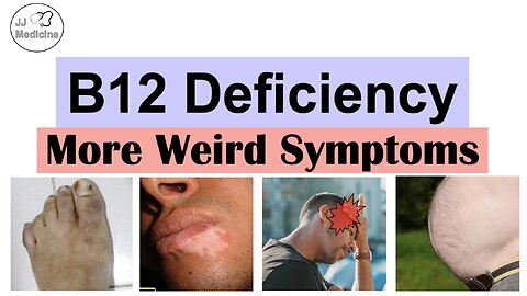 Vitamin B12 Deficiency Weird Symptoms – Part 2 (Types of Headaches, Gastrointestinal and Others)