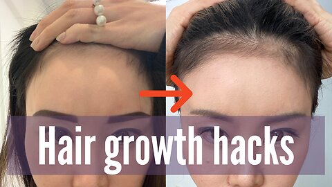 Hair Growth Hacks