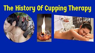 Cupping therapy: An Ancient Healing Practice | The history of cupping massage therapy