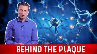 What is Plaque and How to Remove it Explained By Dr. Berg
