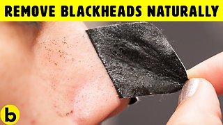 Remove Blackheads, Moles, Warts, And Skin Tags Naturally