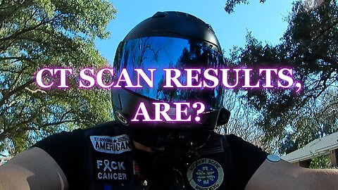 CT SCAN RESULTS, ARE?