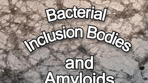 Bacteria Inclusion Bodies and Amyloids