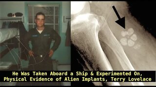 Physical Evidence of Alien Implants & Abduction at Devils Den, Terry Lovelace & Erin Montgomery