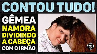 Lembra dos gêmeos siameses mais velhos do mundo? FlNALMENTE ela conseguiu um novo NAM0RADO e...