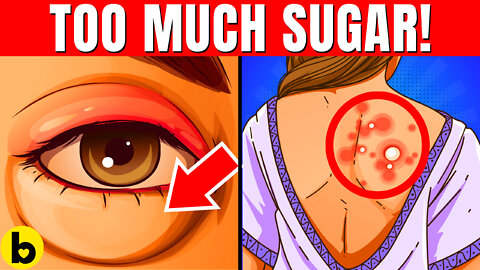You’re Eating TOO MUCH SUGAR If You’re Suffering From These 11 Signs