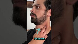 The BEST Self Massage Routine For The Sternocleidomastoid