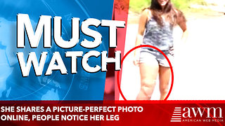 She Shares A Picture-Perfect Photo Online, But Then Strangers Notice Her Leg Looks Strange