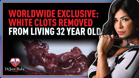 Worldwide Exclusive: White Clots Removed From Living 32 Year Old