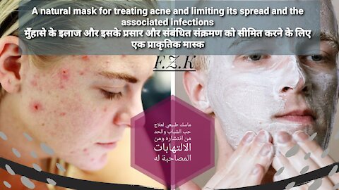 A natural mask to treat acne & melasma & get rid of them permanently & reduce their spread