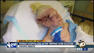 Woman hospitalized after tripping over scooter