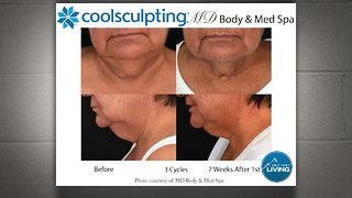 MD Body and Med Spa: Send Stubborn Fat Packing with Coolsculpting.