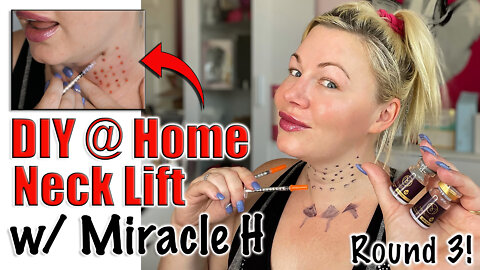 DIY Neck Lift with Miracle H: Round 3 from AceCosm.com | Code Jessica10 Saves you Money!