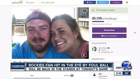 Rockies fan hit in eye by foul ball on Sunday being hosted by team at Wednesday night's game