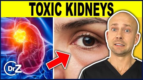10 Warning Signs Your Kidneys Are Toxic