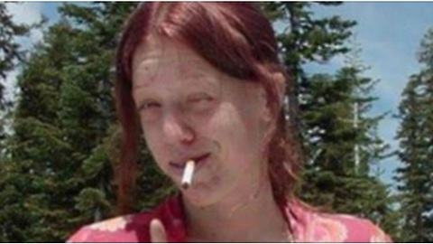 Meth Addict Shares Photo Of Transformation After Becoming Sober, Looks Unrecognizable
