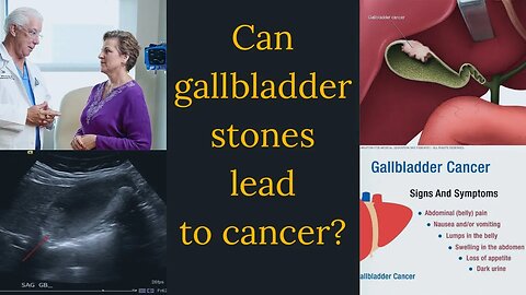 Gallbladder cancer, symptoms, causes, diagnosis & treatment