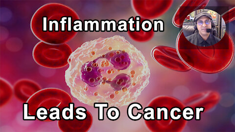 Inflammation Over Time Can Lead To Cancer - Sunil Pai, MD