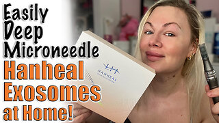 Easily Deep Microneedle Hanheal Exosomes at Home, AceCosm | Code Jessica10 Saves you Money