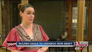 Injured eagle to undergo skin graft