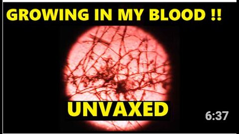 MY UNVAXED BLOOD FROM 4 MONTHS AGO HAS FORMED FIBRES !!