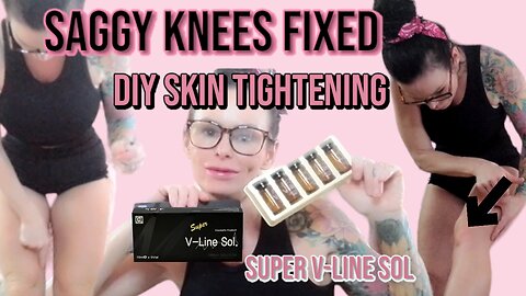 Saggy Knees FIXED at home with Super V-Line Sol - Discount Codes Below - tightening