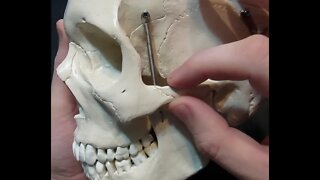 Identification of Bony Landmarks - Zygomatic Bone (Skull)