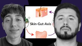 Adoloscent Acne is ACTUALLY Intestinal Destruction