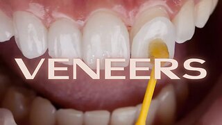Veneers: "Perfect" Teeth Are Only A Few Thousand Dollars Away