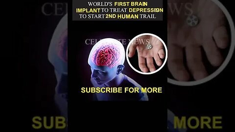 World First Brain Implement Treatment For Depression