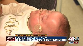 Born at 21 weeks & 6 days, KC baby defies the odds