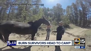 Burn survivors head to camp