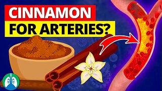 Eat Cinnamon Daily for Healthy Arteries and Blood Flow ❓
