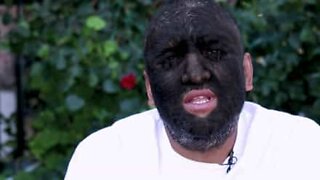 Meet the real wolfman