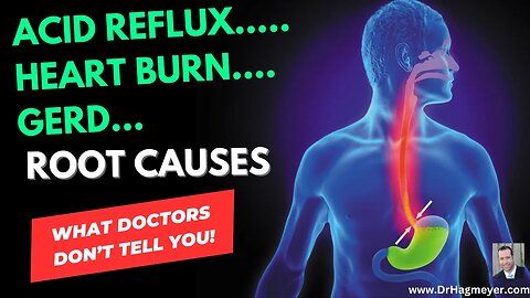 What Causes Acid Reflux & GERD & What Doctors Don't Tell You.