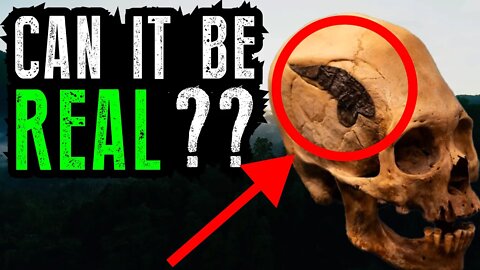 Ancient Skull Metal Implant Mystery