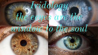 I is for Iridology