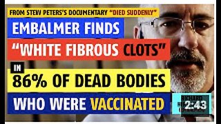 Embalmer finds "white fibrous clots" in 86% of dead people who got the vaccine