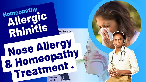 Allergic Rhinitis and Homeopathy Treatment . |Dr. Bharadwaz | Medicine & Surgery Homeopathy