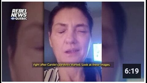 Another Bell's Palsy Coincidence - Carole Avonie
