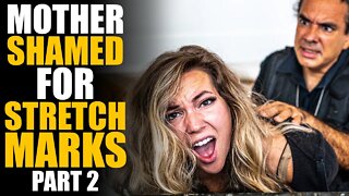 PART 2 Mother SHAMED for having STRETCH MARKS!!! *NOT CLICKBAIT* | SAMEER BHAVNANI