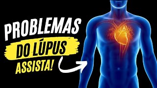 Complicações do Lúpus - Como Se Proteger Das Doenças Cardíacas
