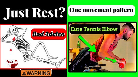 Tennis Elbow Epic Exercises or (Just rest?)