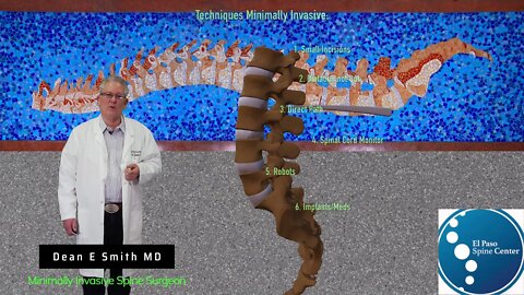 What Is Minimally Invasive Spine Surgery?