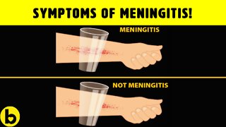 Symptoms of Meningitis That Every Parent Should Know About