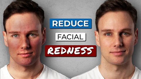 How to GET RID OF REDNESS on your FACE!!