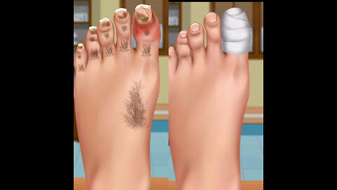 Treatment and cleaning of the injured foot