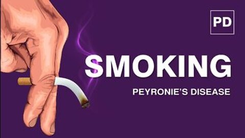 Smoking and Peyronie’s Disease | Risk Factors for Peyronie's Disease & Treatment